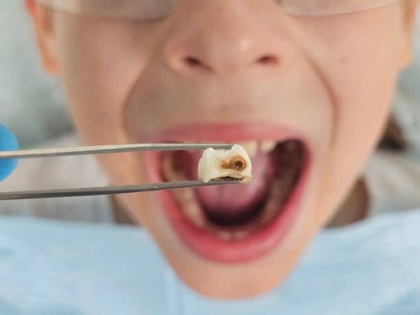 Best Dentist for Dental Trauma  in Bonner West Riverside, MT